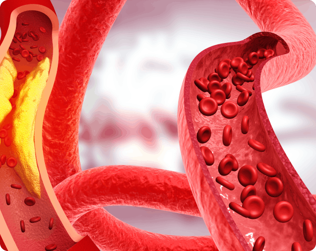 Lorem ipsum dolor sit ame