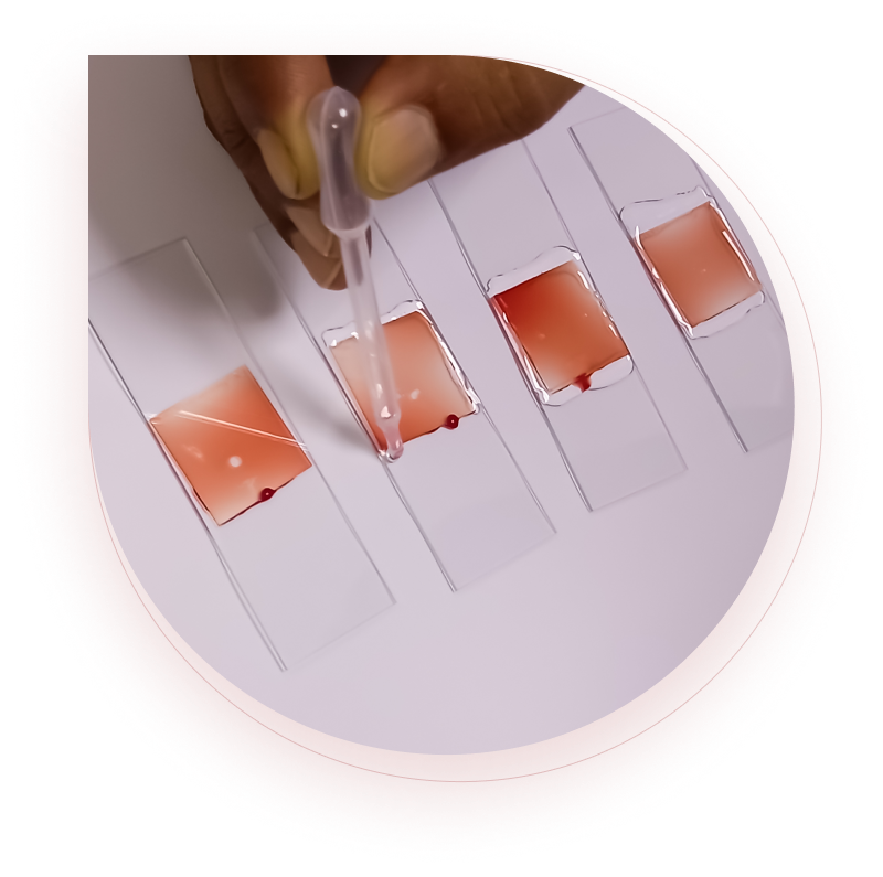 Common bleeding disorders